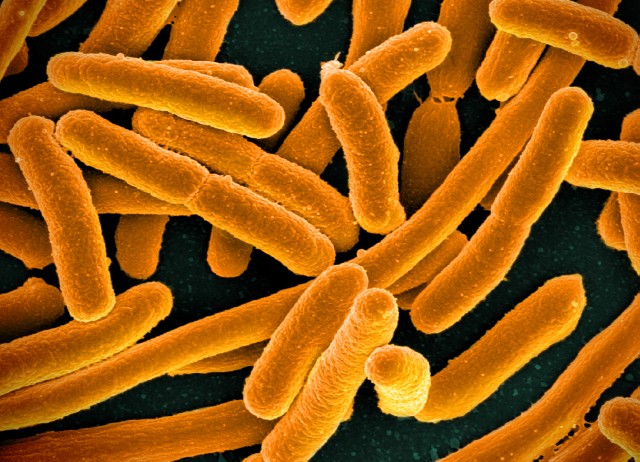 Bacteria E. coli puede causar cancer de intestino